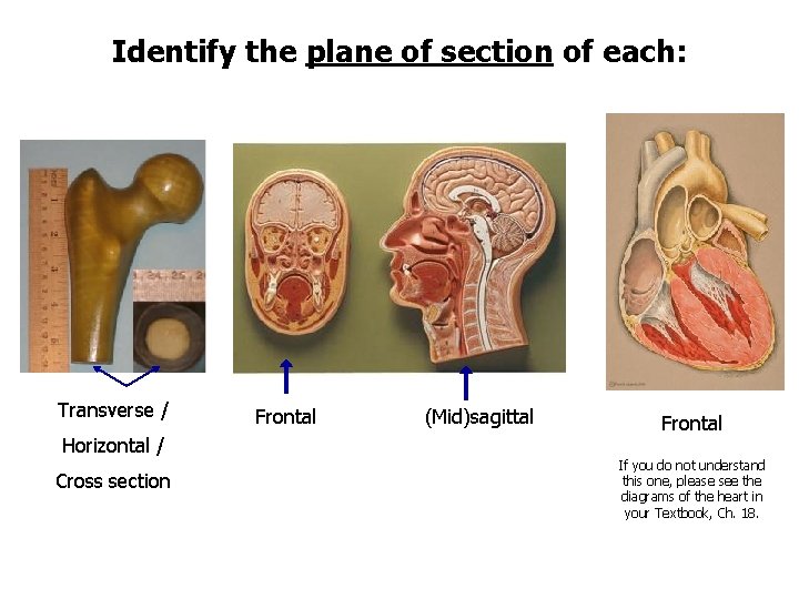 Identify the plane of section of each: Transverse / Horizontal / Cross section Frontal