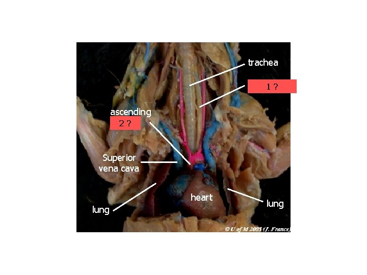 trachea esophagus 1? ascending aorta 2? Superior vena cava heart lung 