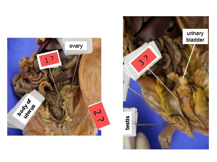 urinary bladder ovary s s a V ? ren 3 efe d testis 2?