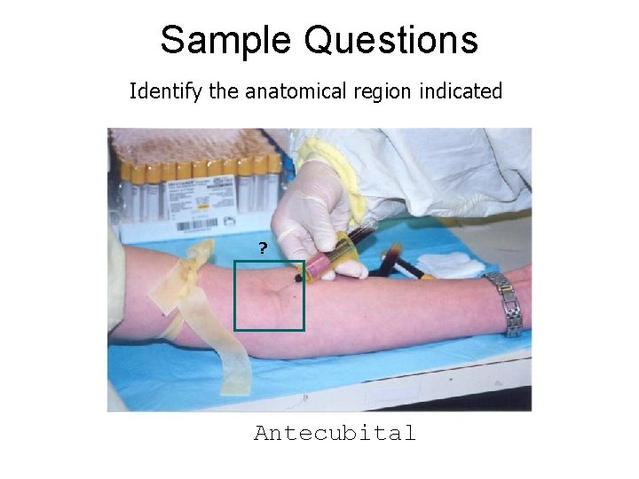 Sample Questions Identify the anatomical region indicated ? Antecubital 