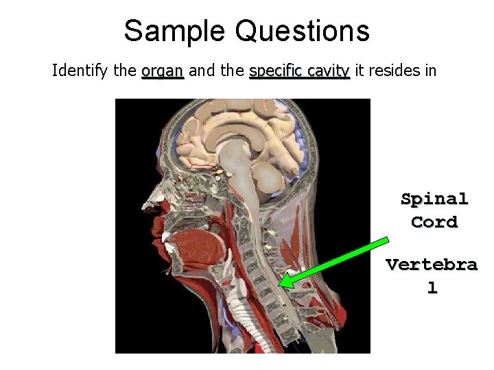 Sample Questions Identify the organ and the specific cavity it resides in Spinal Cord