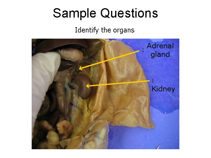 Sample Questions Identify the organs 2 Adrenal gland 1 Kidney 