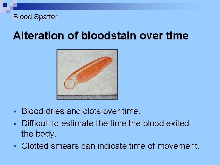 Blood Spatter Alteration of bloodstain over time § § § Blood dries and clots
