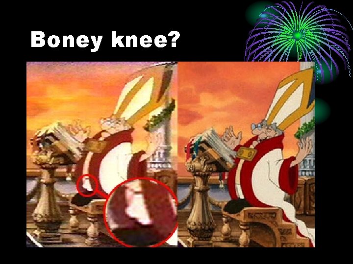 Boney knee? 