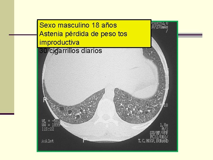 Sexo masculino 18 años Astenia pérdida de peso tos improductiva 30 cigarrillos diarios 