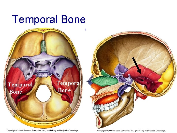 Temporal Bone 