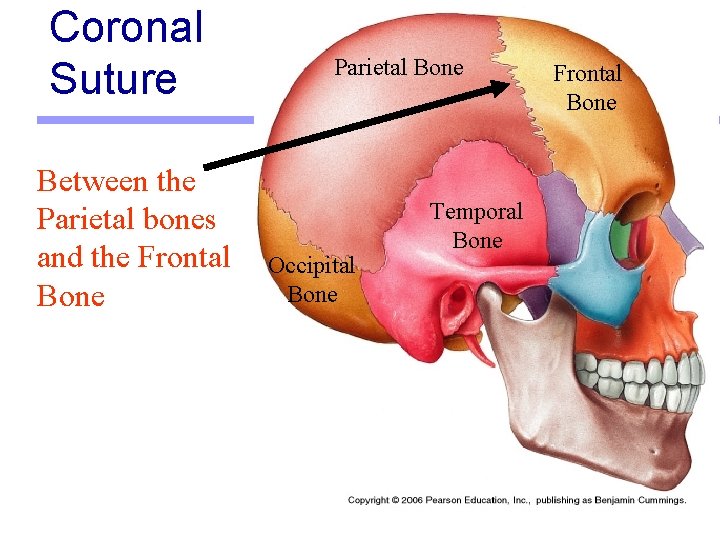 Coronal Suture Between the Parietal bones and the Frontal Bone Parietal Bone Occipital Bone