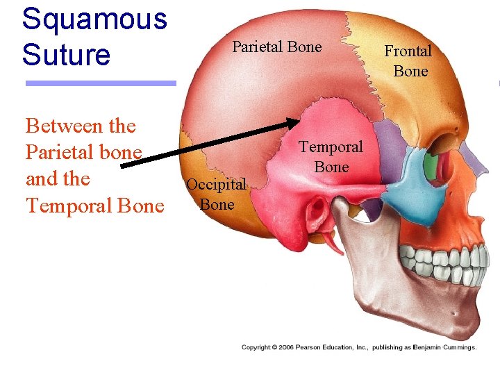 Squamous Suture Between the Parietal bone and the Temporal Bone Parietal Bone Occipital Bone