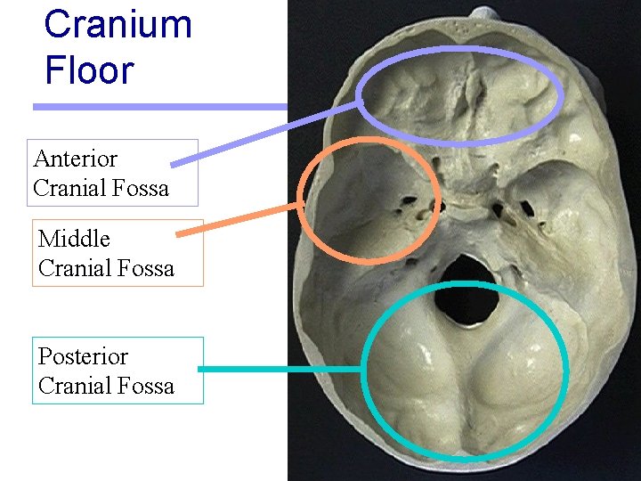 Cranium Floor Anterior Cranial Fossa Middle Cranial Fossa Posterior Cranial Fossa 