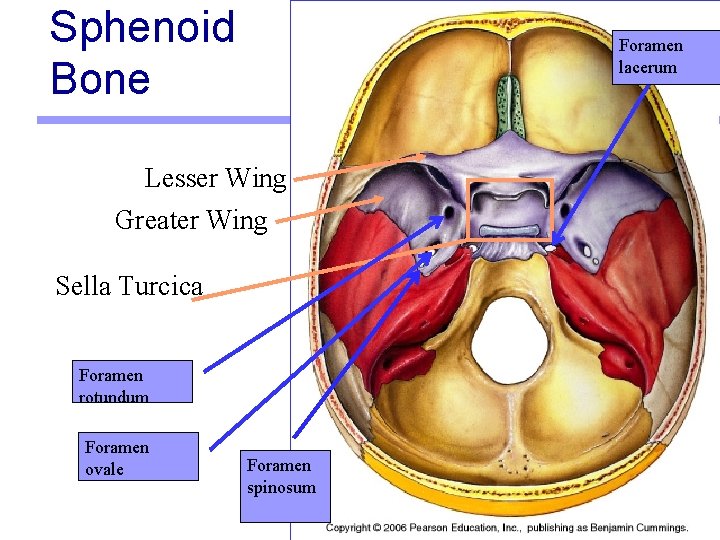 Sphenoid Bone Foramen lacerum Lesser Wing Greater Wing Sella Turcica Foramen rotundum Foramen ovale