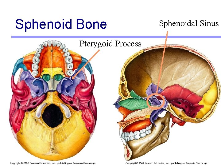 Sphenoid Bone Pterygoid Process Sphenoidal Sinus 