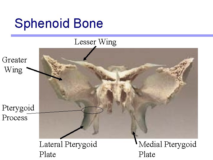 Sphenoid Bone Lesser Wing Greater Wing Pterygoid Process Lateral Pterygoid Plate Medial Pterygoid Plate