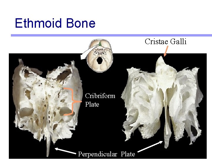 Ethmoid Bone Cristae Galli Cribriform Plate Perpendicular Plate 