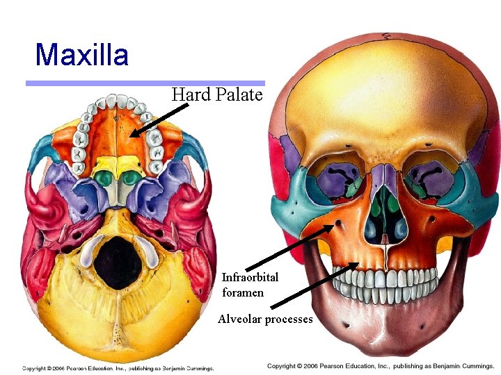 Maxilla Hard Palate Infraorbital foramen Alveolar processes 