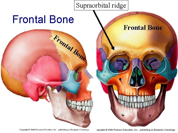 Supraorbital ridge Frontal Bone Fr Frontal Bone on tal Bo ne 