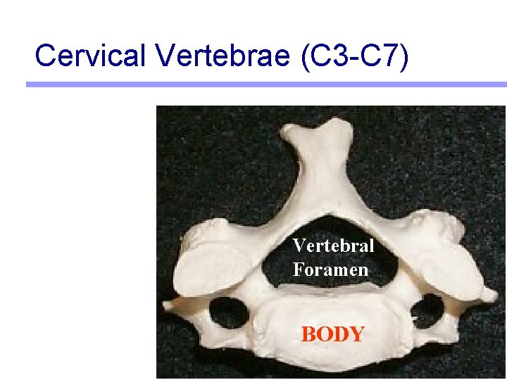 Cervical Vertebrae (C 3 -C 7) Vertebral Foramen BODY 