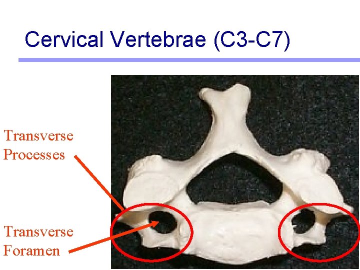 Cervical Vertebrae (C 3 -C 7) Transverse Processes Transverse Foramen 