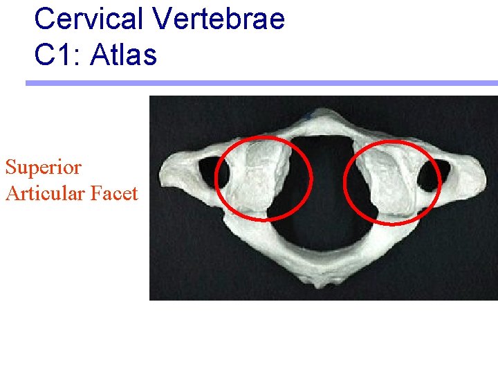 Cervical Vertebrae C 1: Atlas Superior Articular Facet 