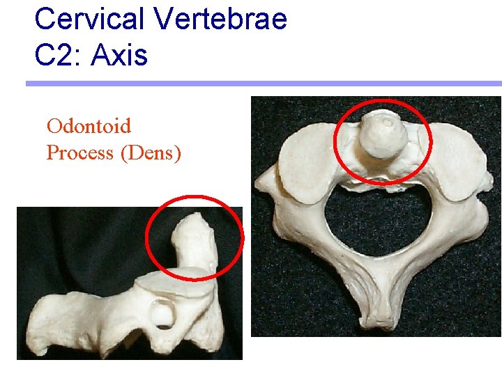 Cervical Vertebrae C 2: Axis Odontoid Process (Dens) 