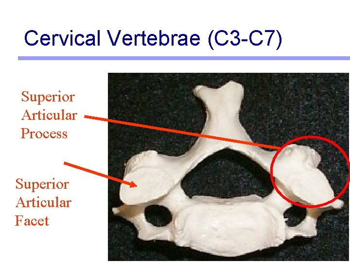 Cervical Vertebrae (C 3 -C 7) Superior Articular Process Superior Articular Facet 