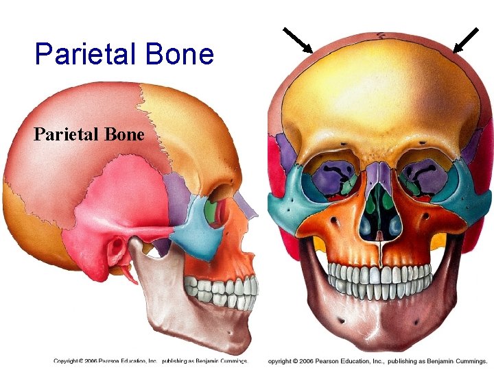 Parietal Bone 