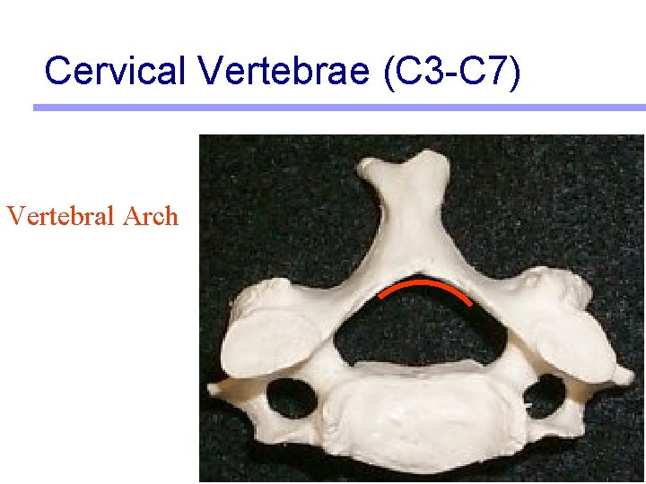 Cervical Vertebrae (C 3 -C 7) Vertebral Arch 