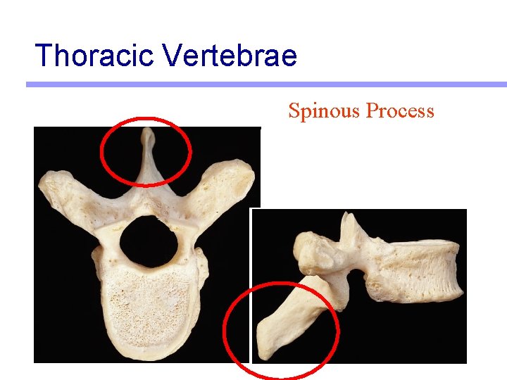 Thoracic Vertebrae Spinous Process 