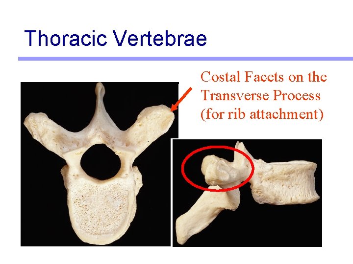 Thoracic Vertebrae Costal Facets on the Transverse Process (for rib attachment) 