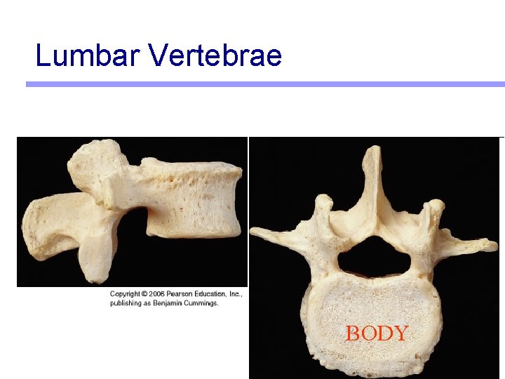 Lumbar Vertebrae BODY 