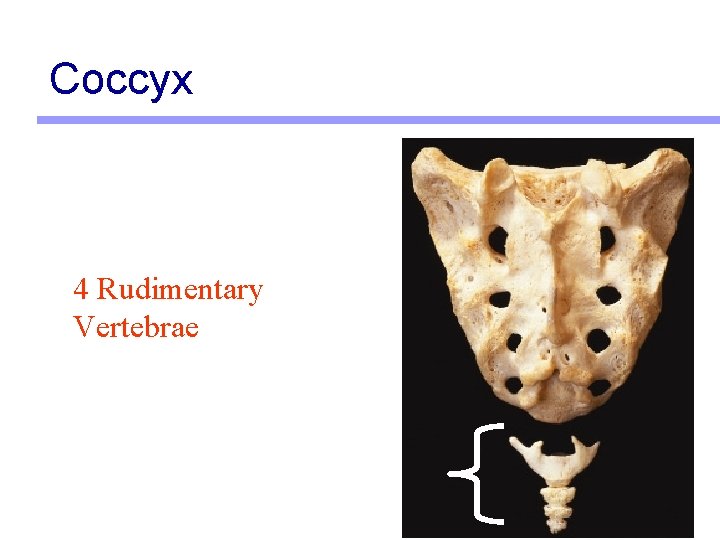 Coccyx 4 Rudimentary Vertebrae 