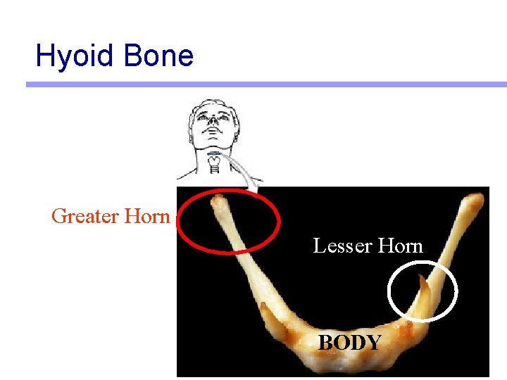 Hyoid Bone Greater Horn Lesser Horn BODY 