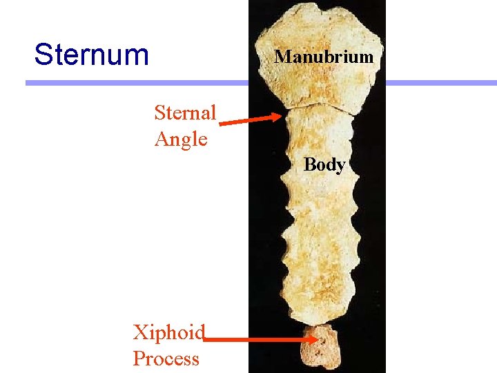 Sternum Manubrium Sternal Angle Body Xiphoid Process 