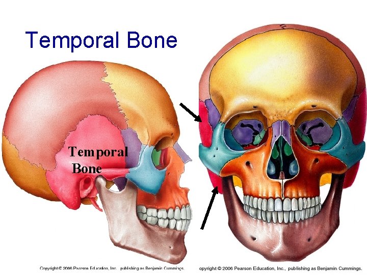 Temporal Bone 
