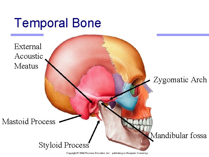 Temporal Bone External Acoustic Meatus Zygomatic Arch Mastoid Process Mandibular fossa Styloid Process 