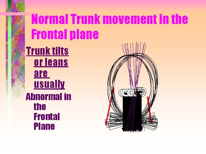Normal Trunk movement in the Frontal plane Trunk tilts or leans are usually Abnormal
