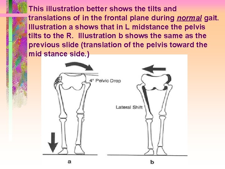 This illustration better shows the tilts and translations of in the frontal plane during