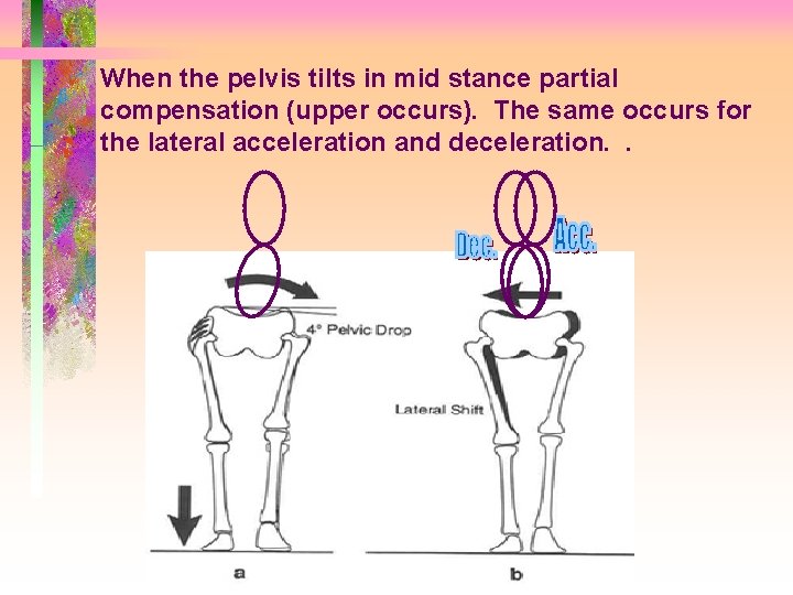 When the pelvis tilts in mid stance partial compensation (upper occurs). The same occurs