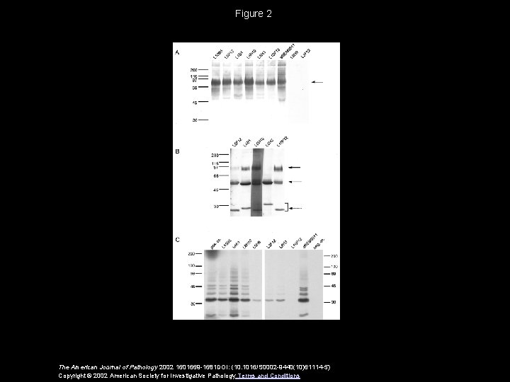 Figure 2 The American Journal of Pathology 2002 1601669 -1681 DOI: (10. 1016/S 0002