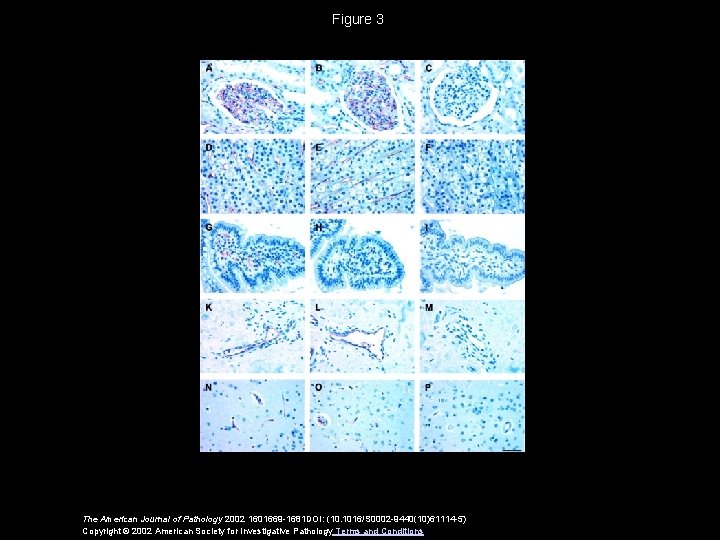 Figure 3 The American Journal of Pathology 2002 1601669 -1681 DOI: (10. 1016/S 0002