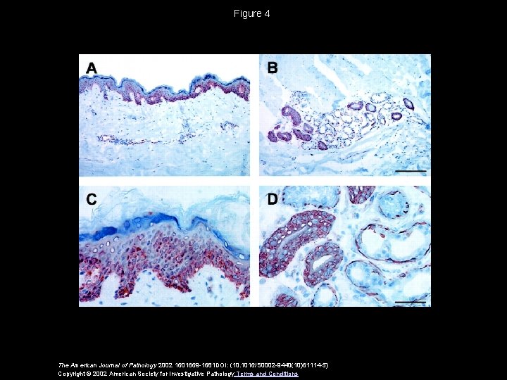 Figure 4 The American Journal of Pathology 2002 1601669 -1681 DOI: (10. 1016/S 0002