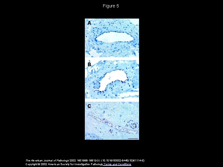 Figure 5 The American Journal of Pathology 2002 1601669 -1681 DOI: (10. 1016/S 0002