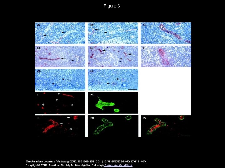 Figure 6 The American Journal of Pathology 2002 1601669 -1681 DOI: (10. 1016/S 0002