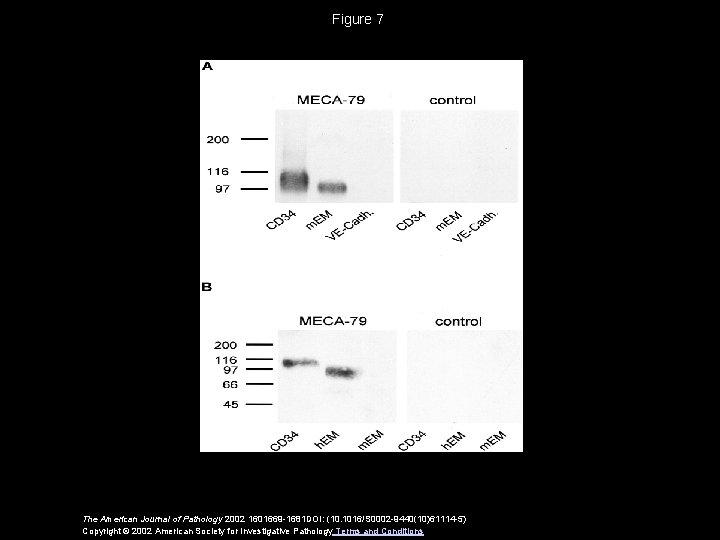 Figure 7 The American Journal of Pathology 2002 1601669 -1681 DOI: (10. 1016/S 0002