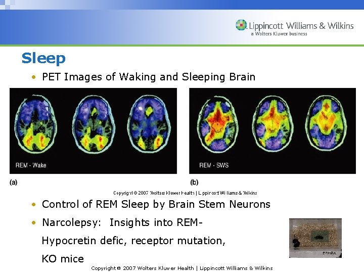 Sleep • PET Images of Waking and Sleeping Brain • Control of REM Sleep