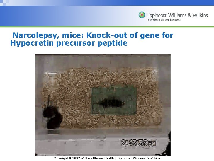 Narcolepsy, mice: Knock-out of gene for Hypocretin precursor peptide Copyright © 2007 Wolters Kluwer