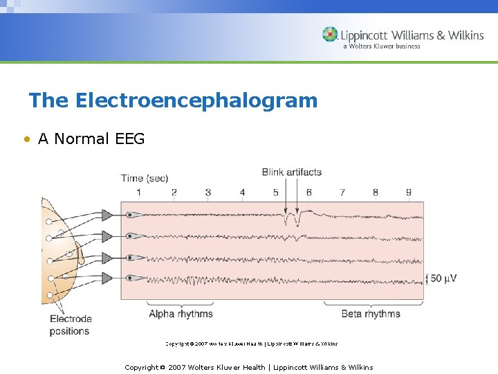 The Electroencephalogram • A Normal EEG Copyright © 2007 Wolters Kluwer Health | Lippincott