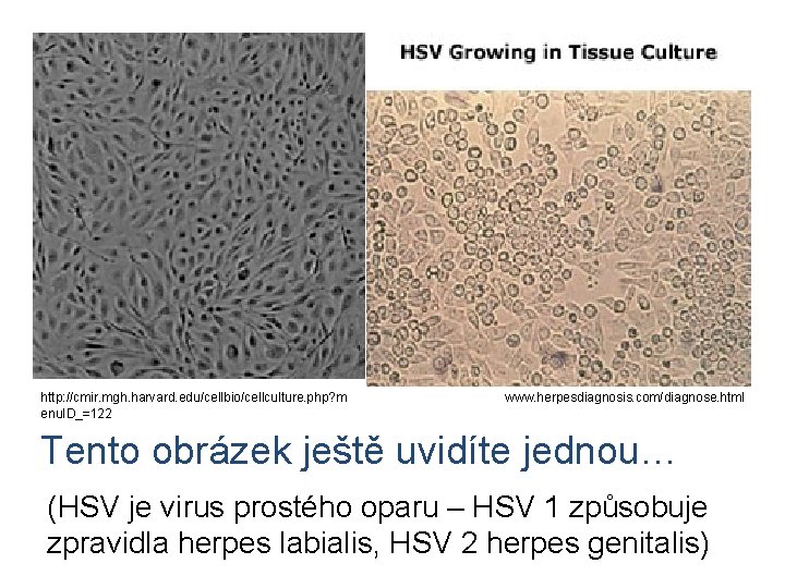 http: //cmir. mgh. harvard. edu/cellbio/cellculture. php? m enu. ID_=122 www. herpesdiagnosis. com/diagnose. html Tento