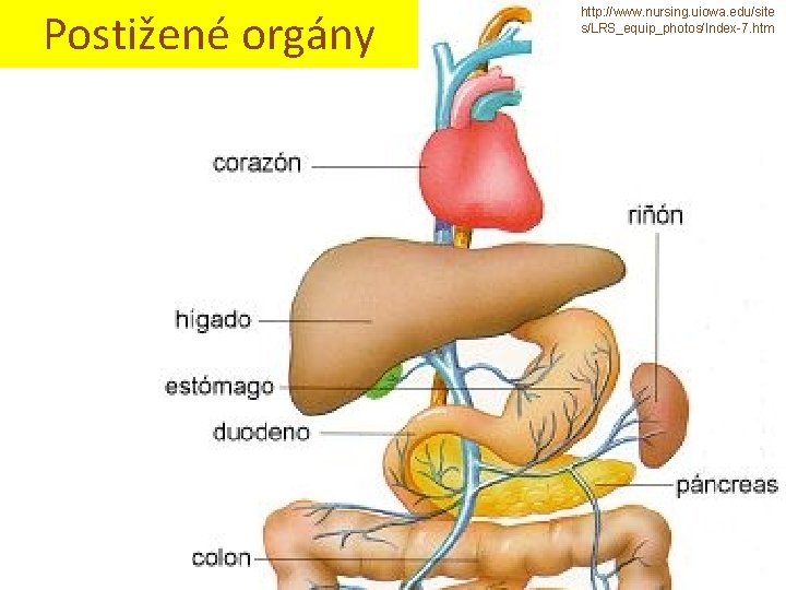 Postižené orgány http: //www. nursing. uiowa. edu/site s/LRS_equip_photos/Index-7. htm 