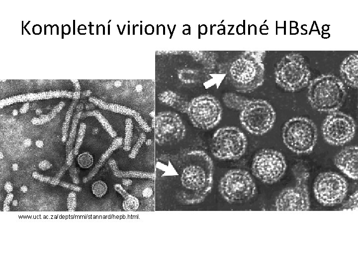 Kompletní viriony a prázdné HBs. Ag www. uct. ac. za/depts/mmi/stannard/hepb. html. 