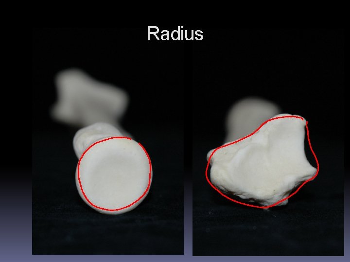 Radius Radius